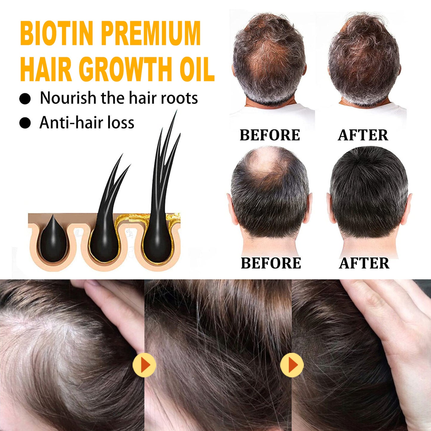 Biotin Hair Treatment Oil